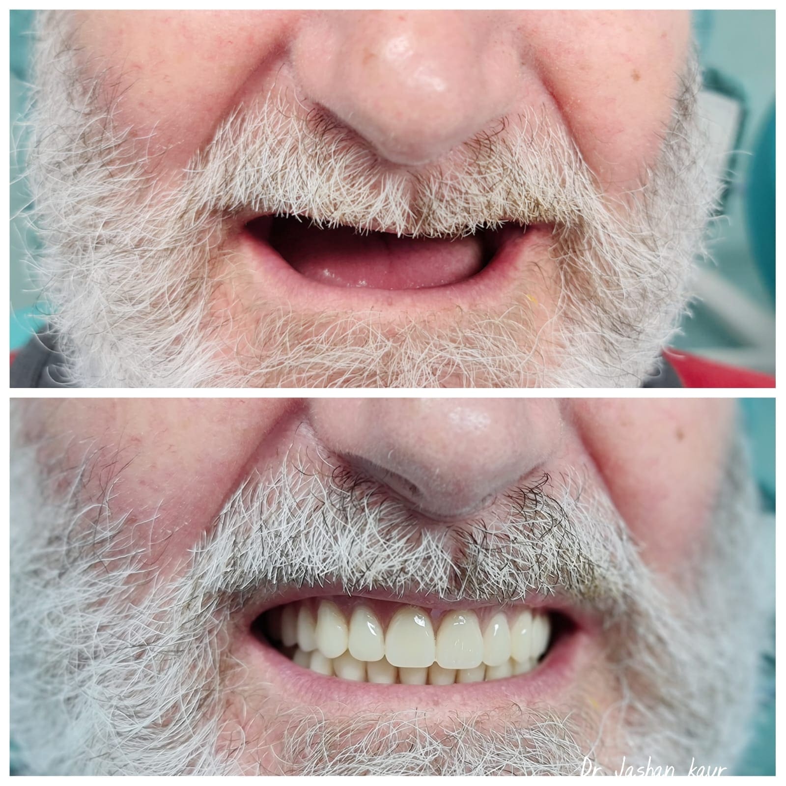 Campbelltown Family Dental Care Zoom bleaching november 2020